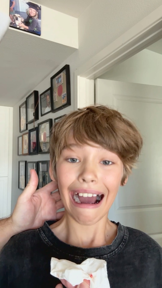 Wrong Tooth!